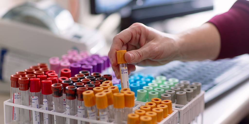 Person holding blood vial 