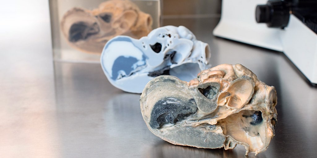 3D printed specimen models that are routinely obtained in the work-up of cardiovascular cases