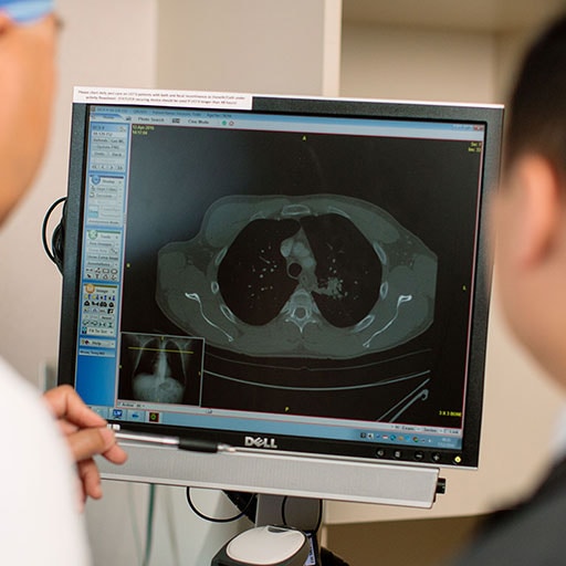 Physicians study scans of interstitial lung disease