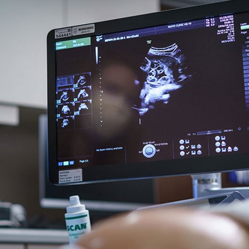 Ultrasound imaging from the obstetrics suite at Mayo Clinic in Minnesota